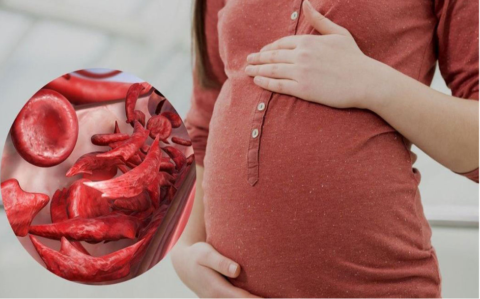 کم خونی در بارداری و تاثیر آن بر جنین