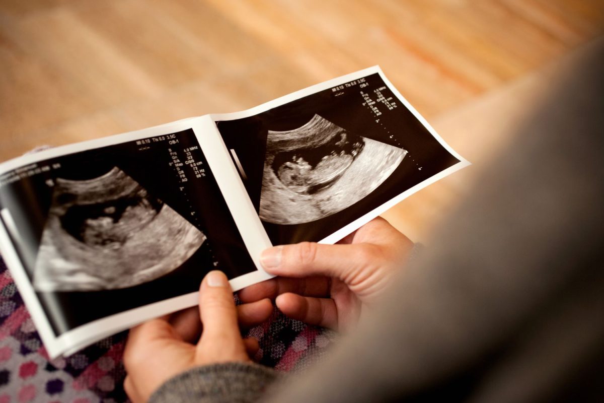 تعیین جنسیت جنین با سونوگرافی