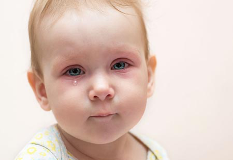 علل و علائم عفونت چشم در کودکان