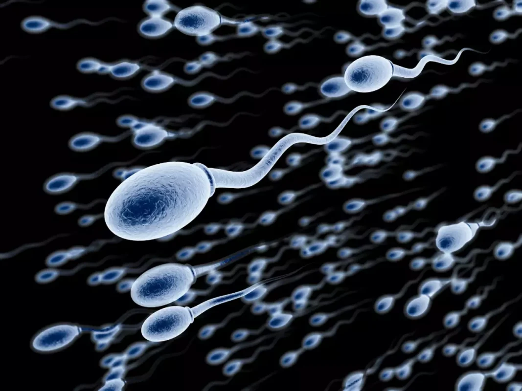کم تحرکی اسپرم عاملی در جهت ناباروری در مردان