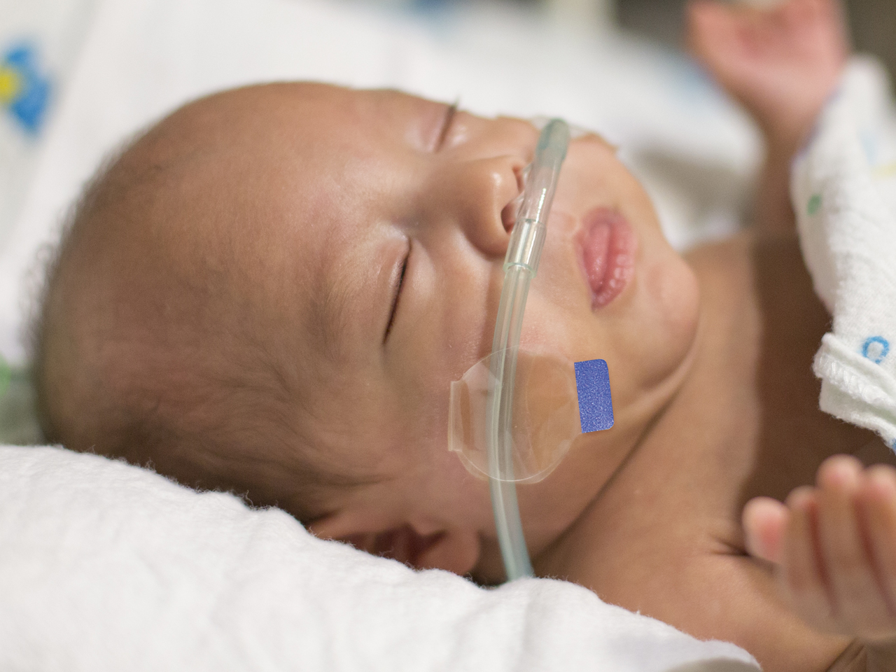کمک به تنفس در نوزادان تاکی پنه گذرا