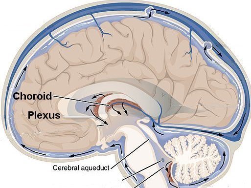 کیست کوروئید مغزی جنین (Choroid Cyst of Fetal Brain)