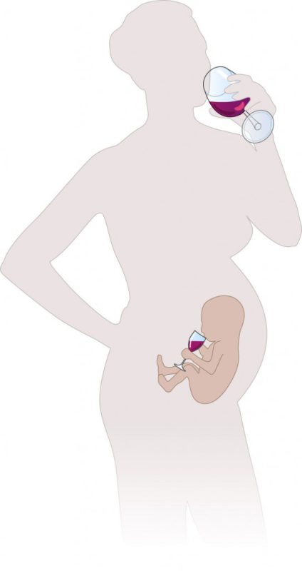ناهنجاری‌های مرتبط با مصرف الکل در دوران بارداری