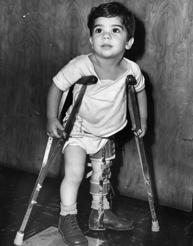 بیماری فلج اطفال POLIO