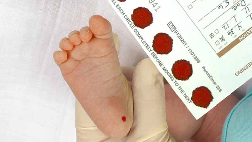 آیا آزمایشهای غربالگری برای تشخیص فنیل کتونوری (PKU) وجود دارد؟