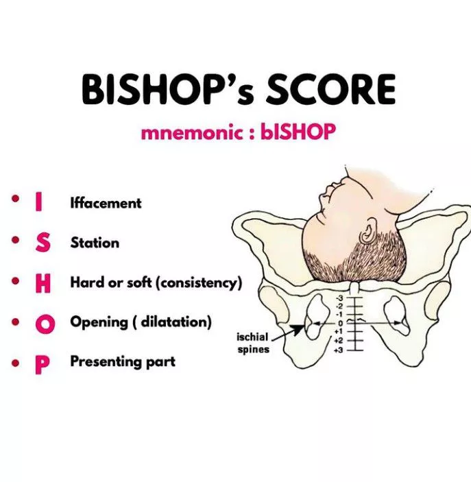 نمره بیشاپ (Bishop's score) چیست؟