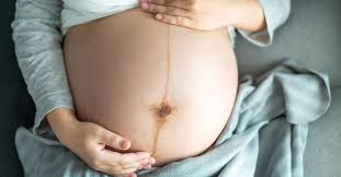 تغییرات سیستم پوششی (پوست) در بارداری