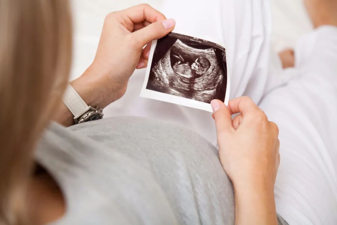 بررسی اندازه طول ران یا Fl در سونوگرافی جنین چیست؟