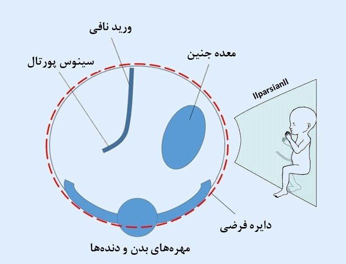تکنیک سونوگرافی برای اسکن شکم (AC) یا دور شکم جنین