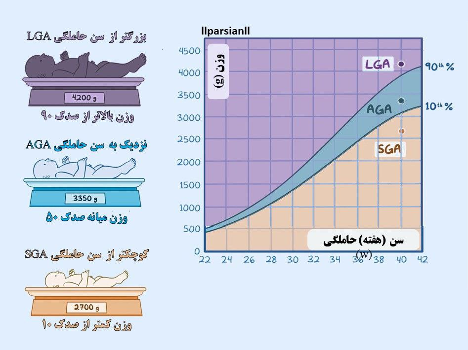 جثه کوچک برای سن حاملگی (SGA)