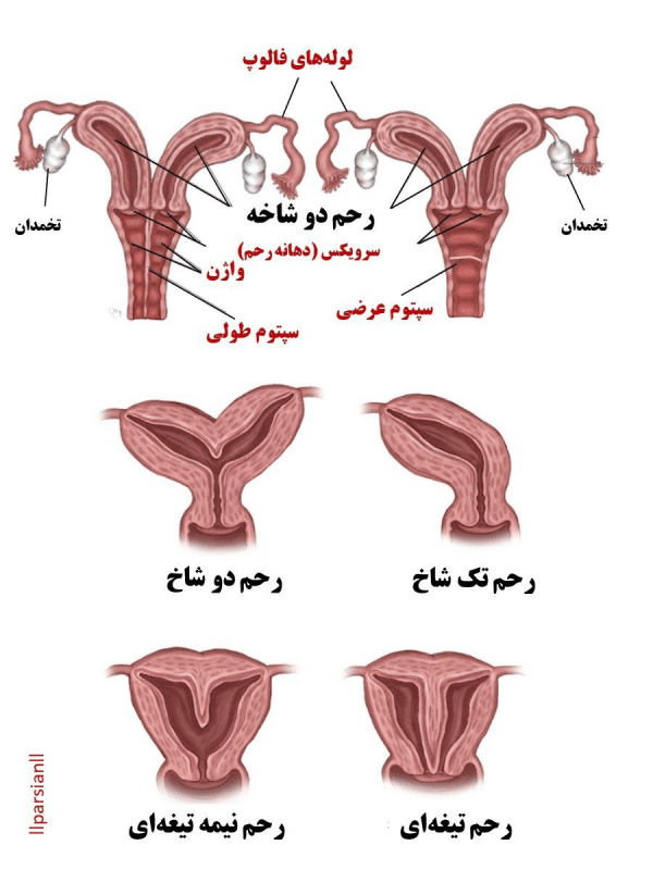 علائم و نشانه‌های انواع سپتوم واژن چیست؟