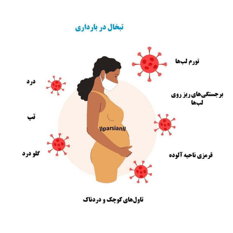 علائم و نشانه‌های تبخال در بارداری