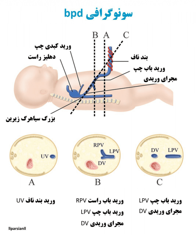 بیومتری جنین شامل چه اندازه گیریهایی میباشد؟