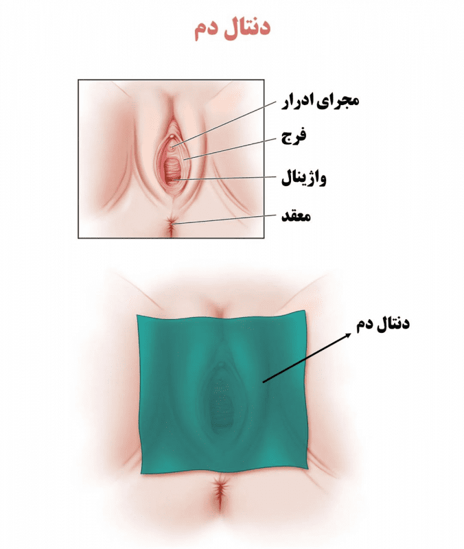 سدهای دندانی (دنتال دم) چگونه کار میکنند؟