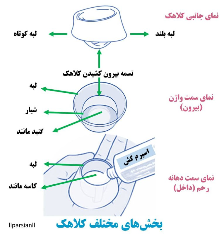کلاه دهانه رحم چیست؟