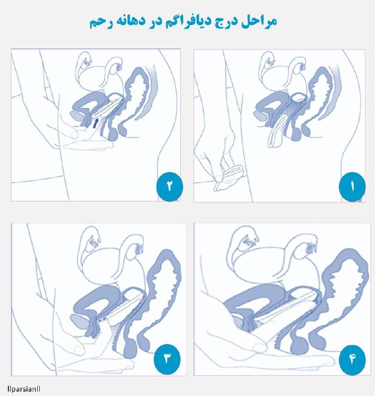 درج دیافراگم
