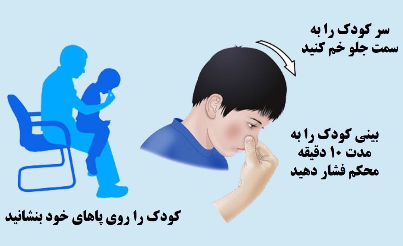 کمکهای اولیه برای خون دماغ در کودکان