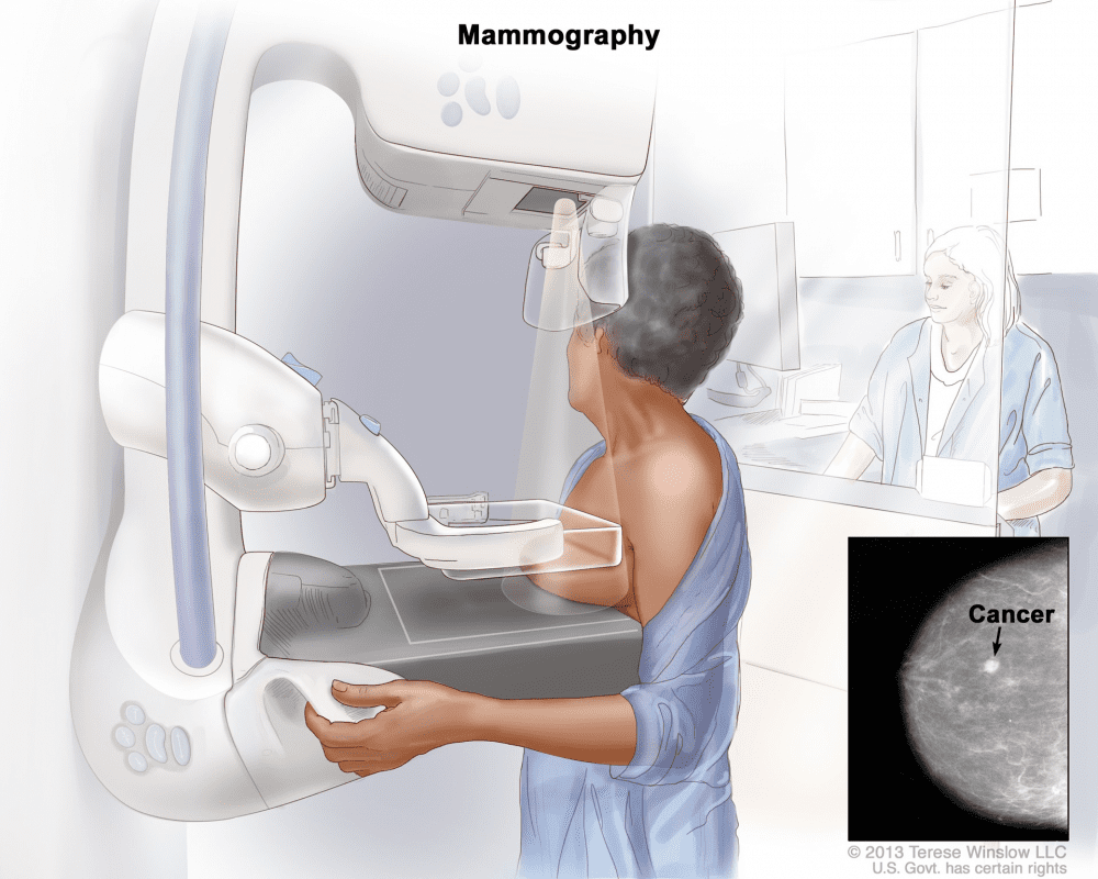 ماموگرافی و توموسنتز چیست؟ چگونه و چرا انجام می‌شود؟