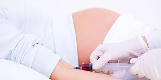 چه سطح هورمونی برای آزمایش بارداری بررسی می‌شود؟