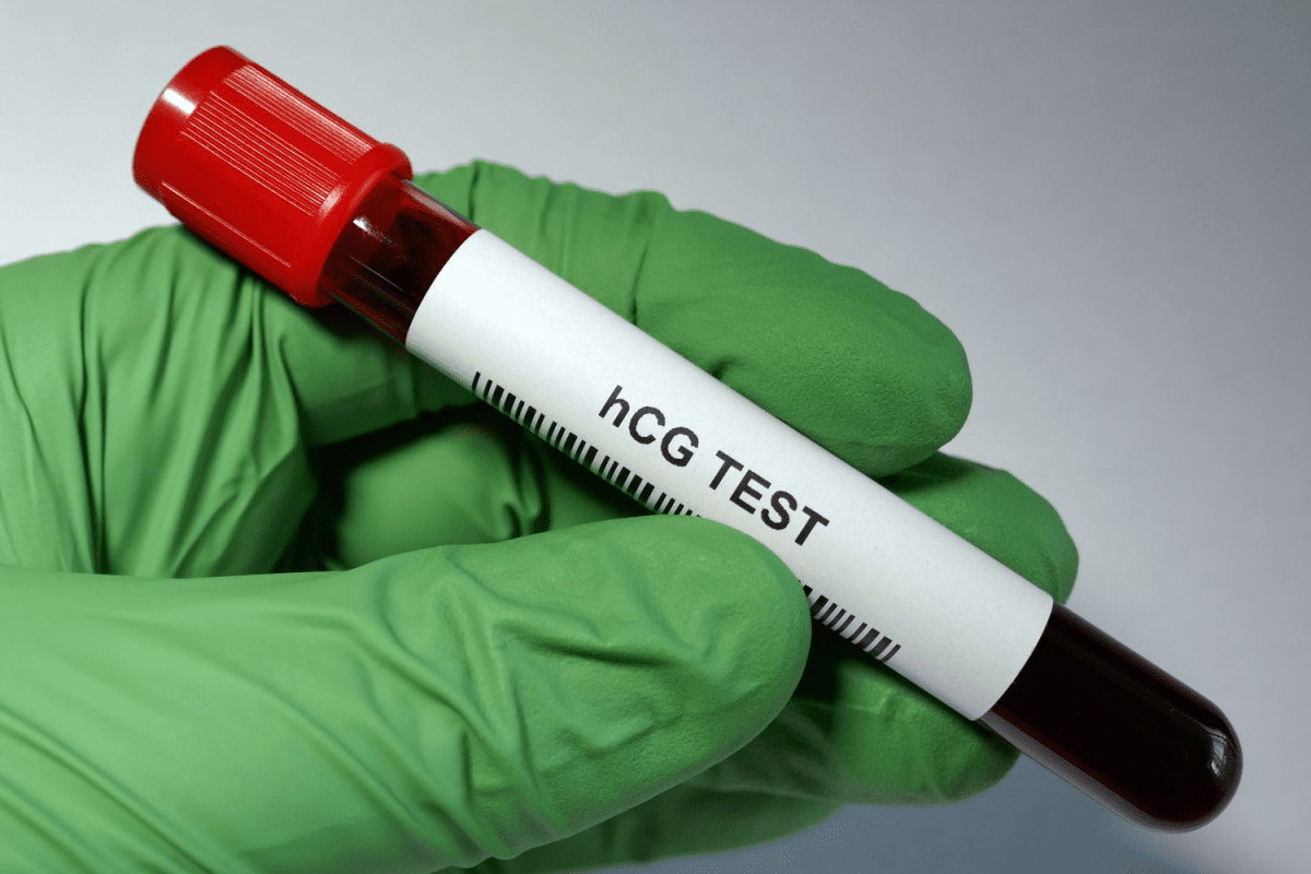 آزمایش خون جهت تعیین بارداری