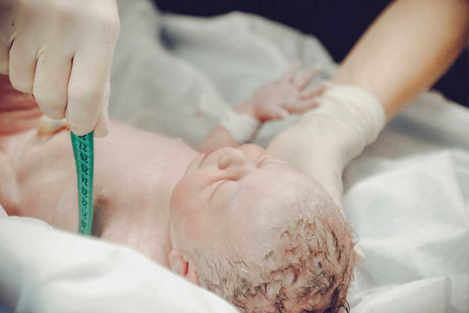 ظاهر نوزاد در بدو تولد