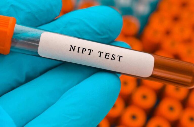 آزمایش NIPT چیست و چه زمانی باید انجام شود؟